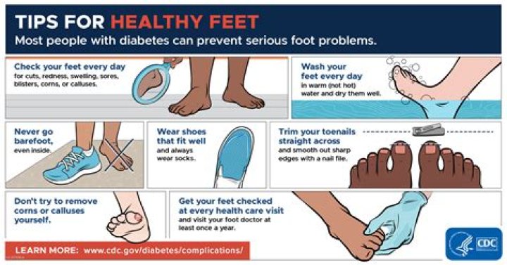 Discovering the Joy of **Loveherfeet**: Simple Ways to Cherish Your Foot Health