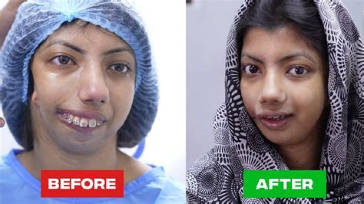 Looking Back: V Stiviano Before Surgery and Public Perception