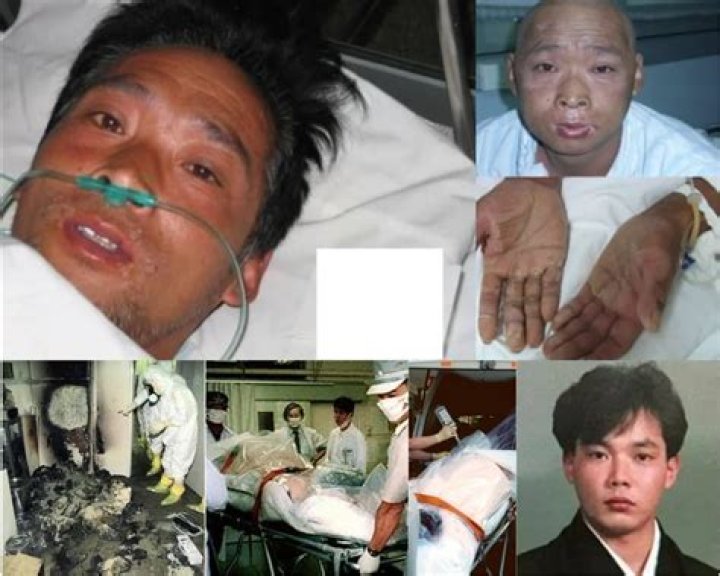 Understanding the Hisashi Ouchi Photo: A Look at a Tragic Event